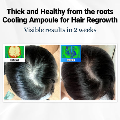 Scalpy™ Scalp Revitalizing Ampoules | Cooling Relief & Hair Density Support (Salicylic Acid & Menthol)