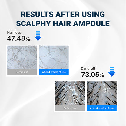 Scalpy™ Scalp Revitalizing Ampoules | Cooling Relief & Hair Density Support (Salicylic Acid & Menthol)