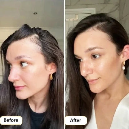 Veganic Hair Growth Oil | 11-in-1 Botanical Blend for Thicker, Fuller & Stronger Hair