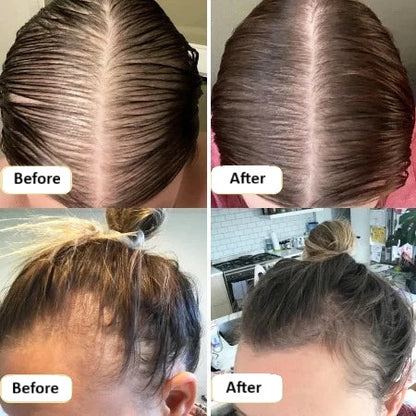 Veganic Hair Growth Oil | 11-in-1 Botanical Blend for Thicker, Fuller & Stronger Hair