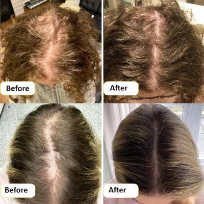 Veganic Hair Growth Oil | 11-in-1 Botanical Blend for Thicker, Fuller & Stronger Hair